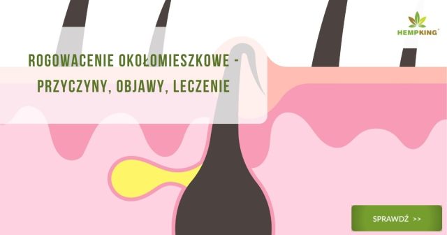 Rogowacenie okołomieszkowe - przyczyny, objawy, leczenie - obrazek wyróżniający