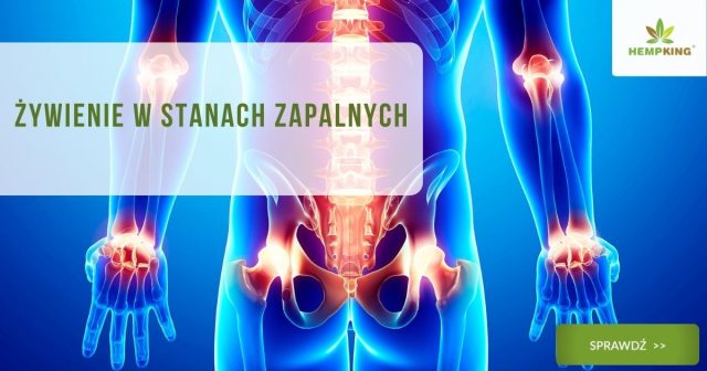 Żywienie w stanach zapalnych - antyzapalne produkty spożywcze - obrazek wyróżniający