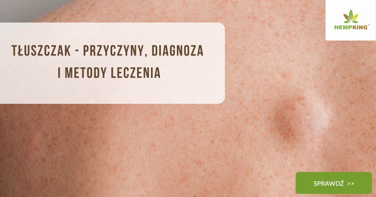 Tłuszczak - przyczyny, diagnoza i metody leczenia - obrazek wyróżniający