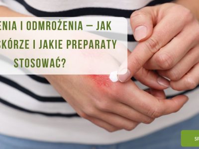 Oparzenia i odmrożenia – jak pomóc skórze i jakie preparaty stosować - obrazek wyróżniający