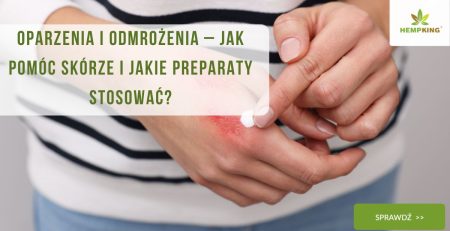 Oparzenia i odmrożenia – jak pomóc skórze i jakie preparaty stosować - obrazek wyróżniający