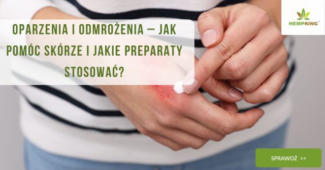 Oparzenia i odmrożenia – jak pomóc skórze i jakie preparaty stosować - obrazek wyróżniający