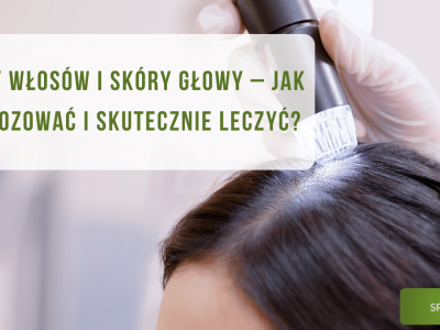 Choroby włosów i skóry głowy – jak je diagnozować i skutecznie leczyć? - obrazek wyróżniający