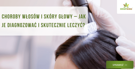 Choroby włosów i skóry głowy – jak je diagnozować i skutecznie leczyć? - obrazek wyróżniający