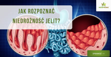 Jak rozpoznać niedrożność jelit? - obrazek wyróżniający