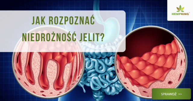 Jak rozpoznać niedrożność jelit? - obrazek wyróżniający