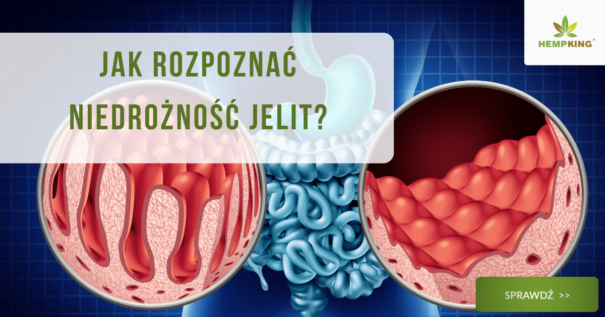 Jak rozpoznać niedrożność jelit? - obrazek wyróżniający