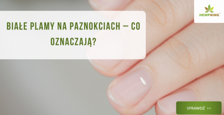 Białe plamy na paznokciach – co oznaczają? - obrazek wyróżniający