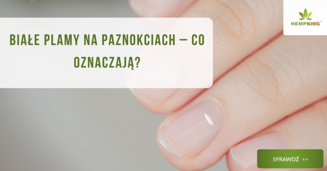 Białe plamy na paznokciach – co oznaczają? - obrazek wyróżniający