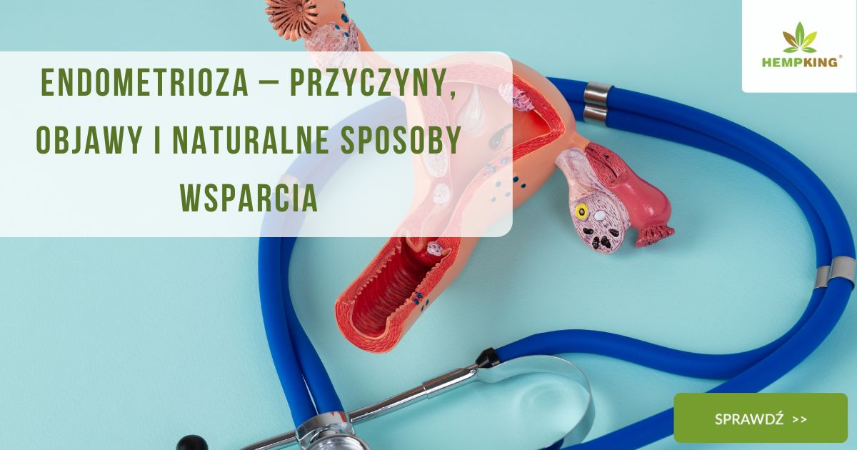 Endometrioza–przyczyny, objawy i naturalne sposoby wsparcia - obrazek wyróżniający