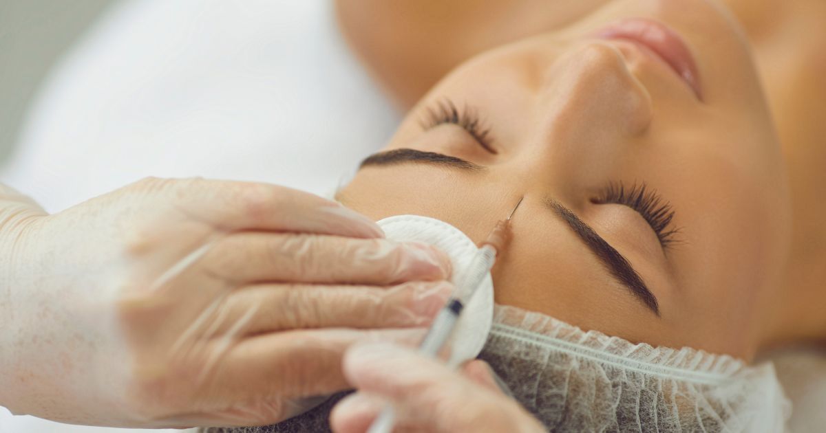 Botoks na lwią zmarszczkę - zdjęcie poglądowe