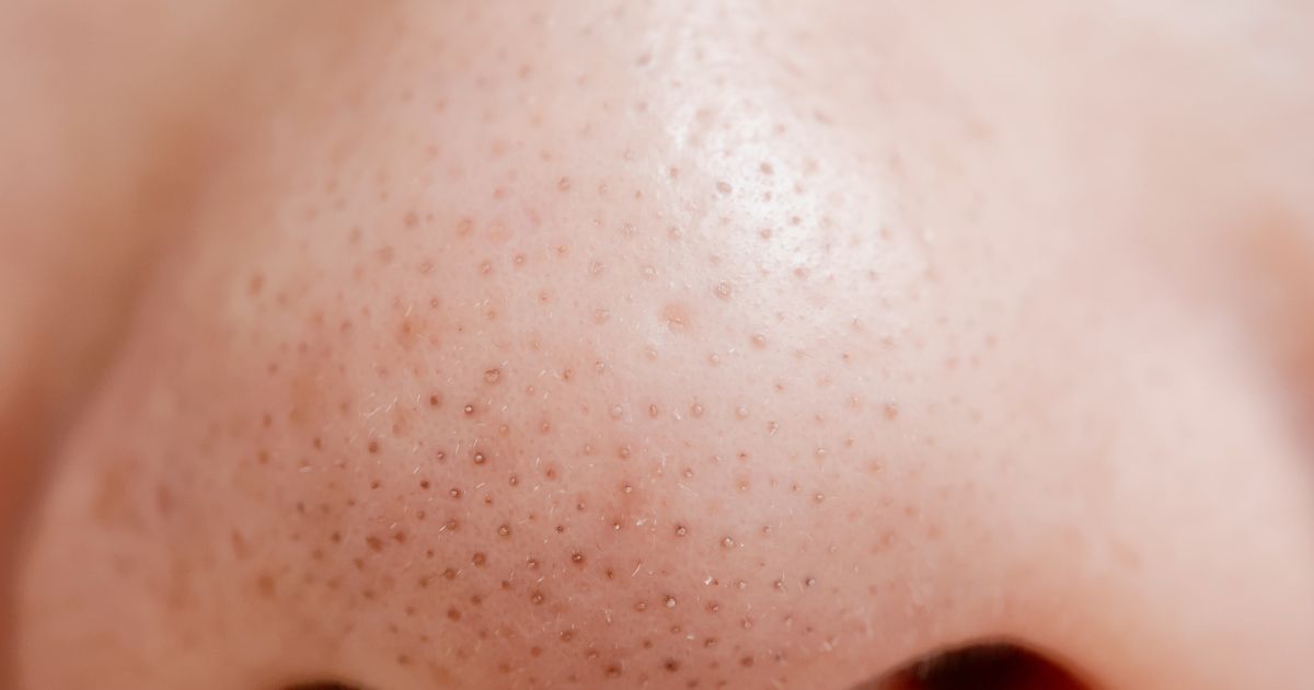 Zaskórniki - zdjęcie poglądowe