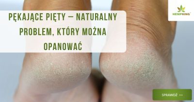 Pękające pięty – naturalny problem, który można opanować - obrazek wyróżniający