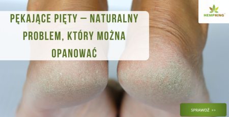 Pękające pięty – naturalny problem, który można opanować - obrazek wyróżniający