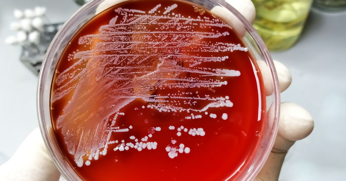 Gronkowiec złocisty - zdjęcie poglądowe