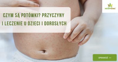 Czym są potówki Przyczyny i leczenie u dzieci i dorosłych - obrazek wyróżniający