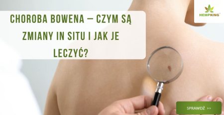 Choroba Bowena – czym są zmiany in situ i jak je leczyć? - obrazek wyróżniający