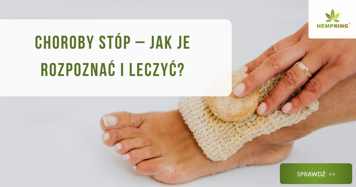 Choroby stóp – jak je rozpoznać i leczyć? - obrazek wyróżniający