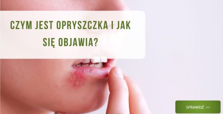 Czym jest opryszczka i jak się objawia? - obrazek wyróżniający
