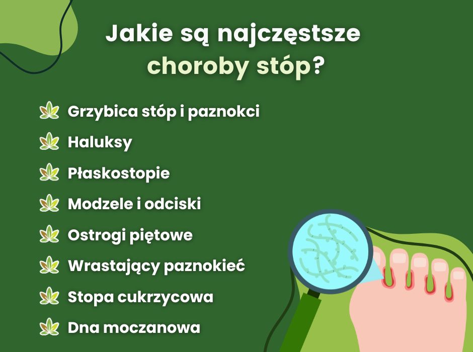 Najczęstsze choroby stóp - infografika