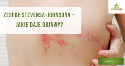 Zespół Stevensa-Johnsona – jakie daje objawy? - obrazek wyróżniający