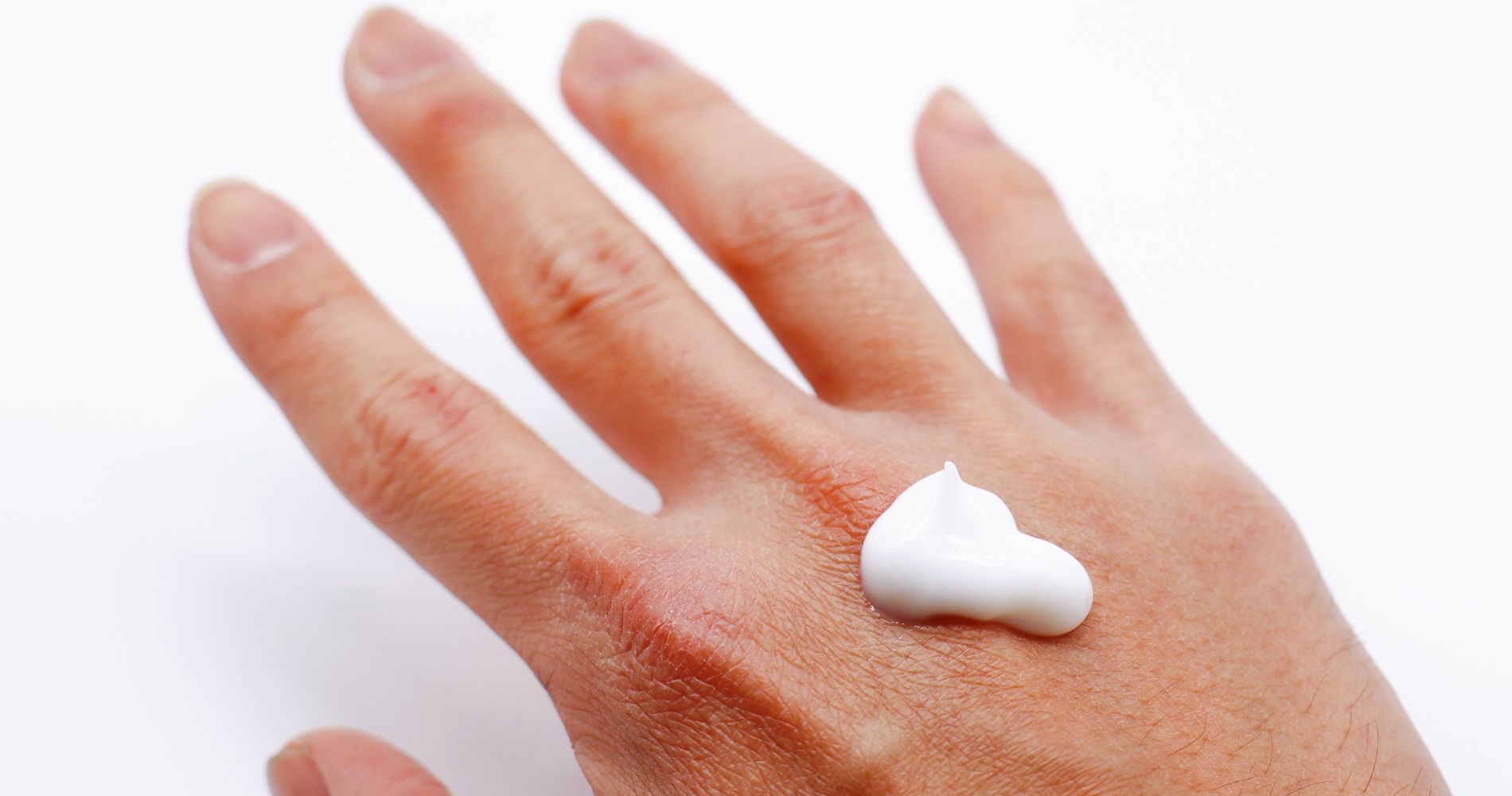 Krem z mocznikiem na skórze dłoni – nawilżenie i regeneracja suchej skóry.