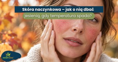 Skóra naczynkowa – jak o nią dbać jesienią, gdy temperatura spada? - obrazek wyróżniający